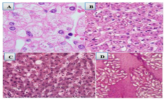 Histopathological features of camel liver infected with Platyhelminthes